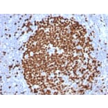 Immunohistochemistry - Anti-Ki67 Antibody [MKI67/2465] (A249347) - Antibodies.com