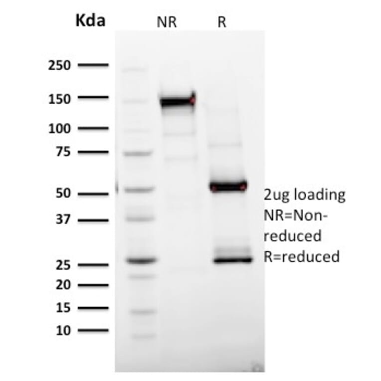 SDS-PAGE - Anti-Ki67 Antibody [MKI67/2465] (A249347) - Antibodies.com