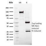 SDS-PAGE - Anti-Ki67 Antibody [MKI67/2465] (A249347) - Antibodies.com