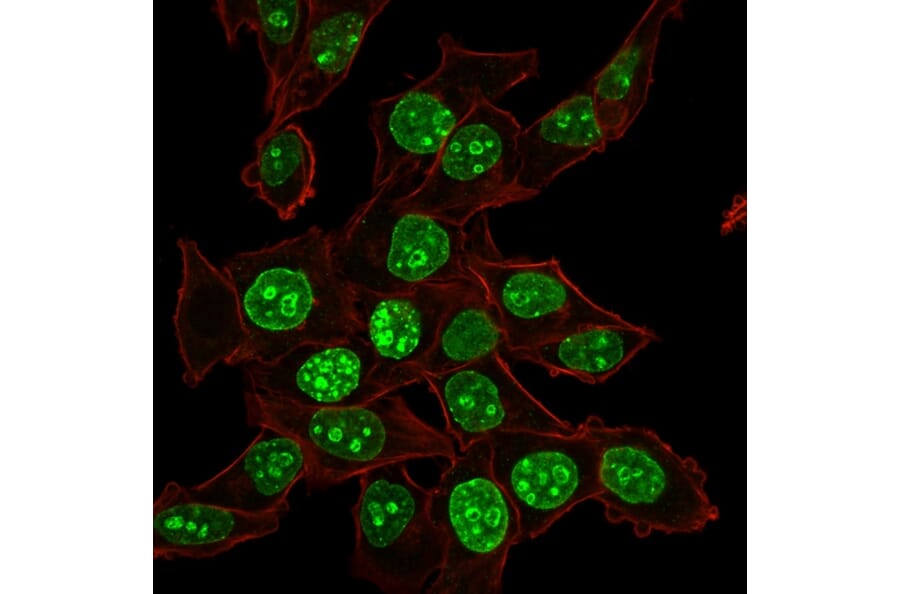 Immunofluorescence - Anti-Ki67 Antibody [MKI67/2465] (A249347) - Antibodies.com