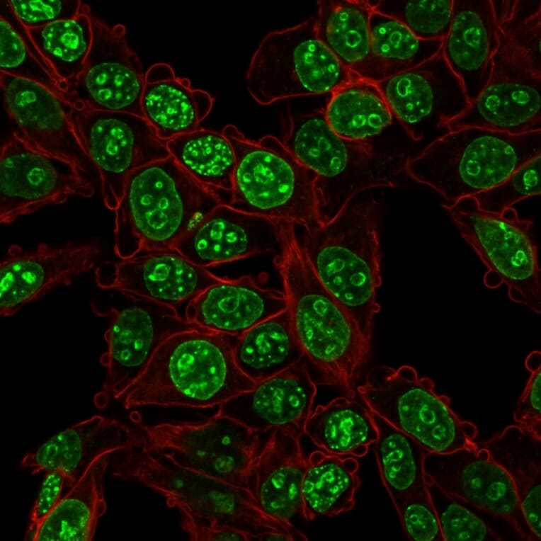 Immunofluorescence - Anti-Ki67 Antibody [MKI67/2466] (A249348) - Antibodies.com