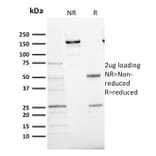 SDS-PAGE - Anti-Ki67 Antibody [MKI67/2466] (A249348) - Antibodies.com