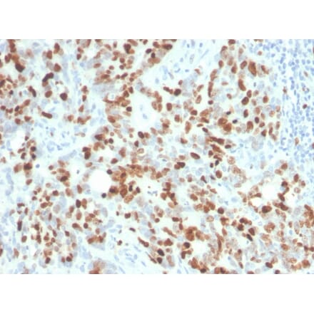 Immunohistochemistry - Anti-Ki67 Antibody [MKI67/4945R] (A249348) - Antibodies.com