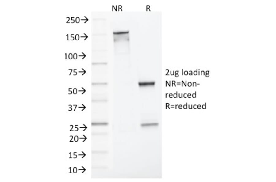 SDS-PAGE - Anti-MLH1 Antibody [MLH1/1324] (A249350) - Antibodies.com