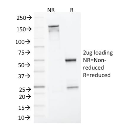 SDS-PAGE - Anti-MLH1 Antibody [MLH1/1324] (A249350) - Antibodies.com