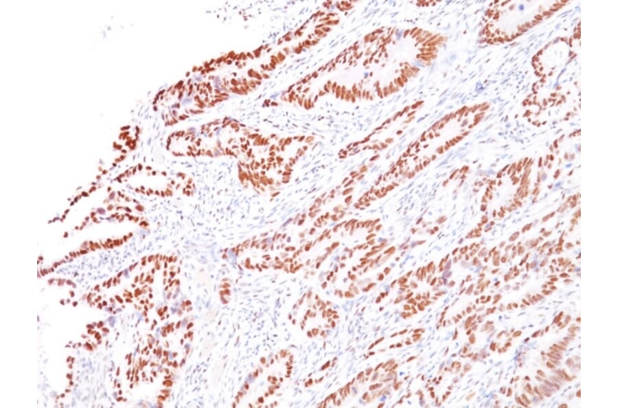 Immunohistochemistry - Anti-MLH1 Antibody [G168-728] (A249351) - Antibodies.com