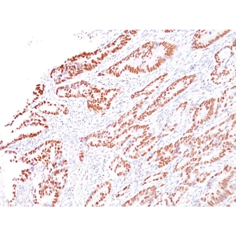 Immunohistochemistry - Anti-MLH1 Antibody [G168-728] (A249351) - Antibodies.com