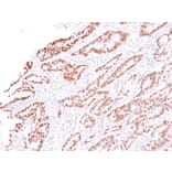 Immunohistochemistry - Anti-MLH1 Antibody [G168-728] (A249351) - Antibodies.com
