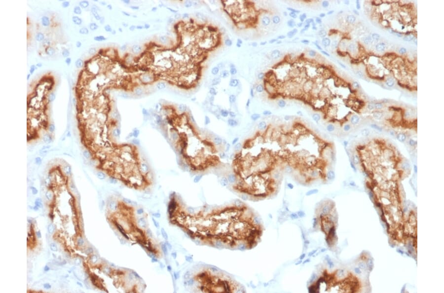 Immunohistochemistry - Anti-CD10 Antibody [MME/1870] (A249353) - Antibodies.com