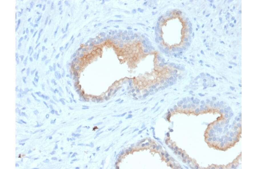 Immunohistochemistry - Anti-CD10 Antibody [MME/1870] (A249353) - Antibodies.com