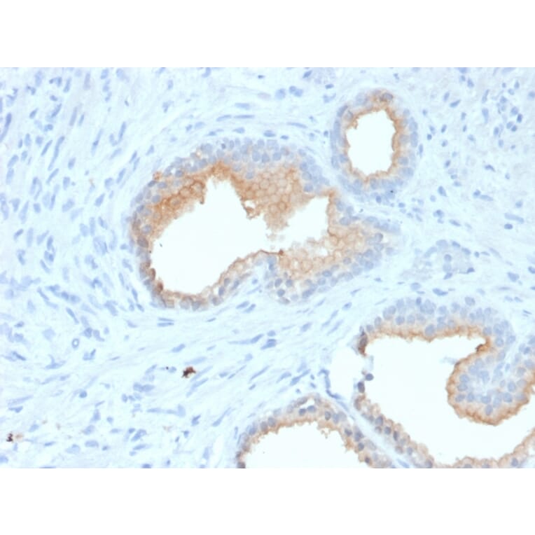 Immunohistochemistry - Anti-CD10 Antibody [MME/1870] (A249353) - Antibodies.com