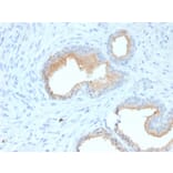 Immunohistochemistry - Anti-CD10 Antibody [MME/1870] (A249353) - Antibodies.com