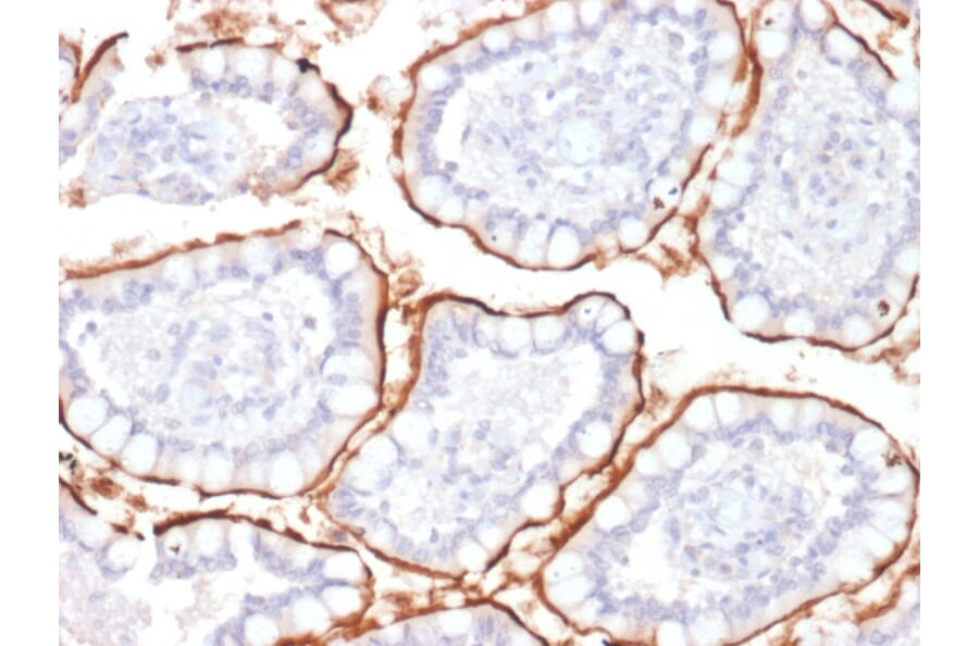 Immunohistochemistry - Anti-CD10 Antibody [MME/1870] (A249353) - Antibodies.com