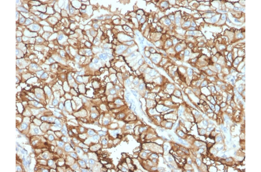 Immunohistochemistry - Anti-CD10 Antibody [MME/1870] (A249353) - Antibodies.com
