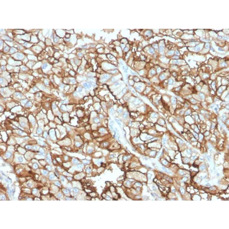 Immunohistochemistry - Anti-CD10 Antibody [MME/1870] (A249353) - Antibodies.com