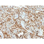 Immunohistochemistry - Anti-CD10 Antibody [MME/1870] (A249353) - Antibodies.com