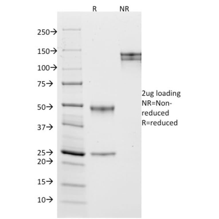 SDS-PAGE - Anti-CD10 Antibody [MME/1870] (A249353) - Antibodies.com