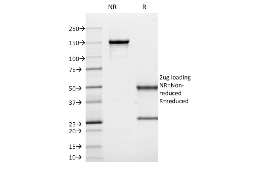SDS-PAGE - Anti-CD10 Antibody [MME/1620] (A249354) - Antibodies.com