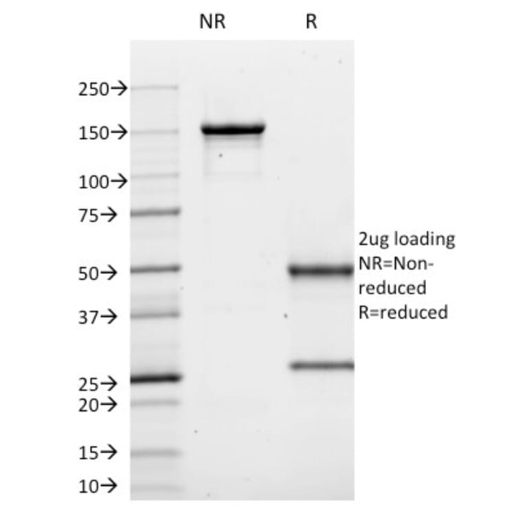 SDS-PAGE - Anti-CD10 Antibody [MME/1620] (A249354) - Antibodies.com