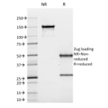 SDS-PAGE - Anti-CD10 Antibody [MME/1620] (A249354) - Antibodies.com