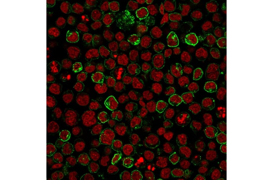 Immunofluorescence - Anti-CD10 Antibody [MME/1620] (A249354) - Antibodies.com