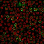 Immunofluorescence - Anti-CD10 Antibody [MME/1620] (A249354) - Antibodies.com