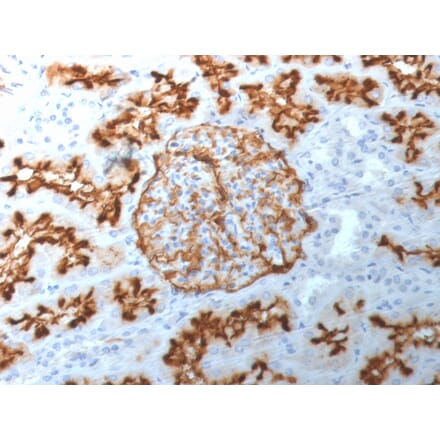 Immunohistochemistry - Anti-CD10 Antibody [MME/1892] (A249355) - Antibodies.com