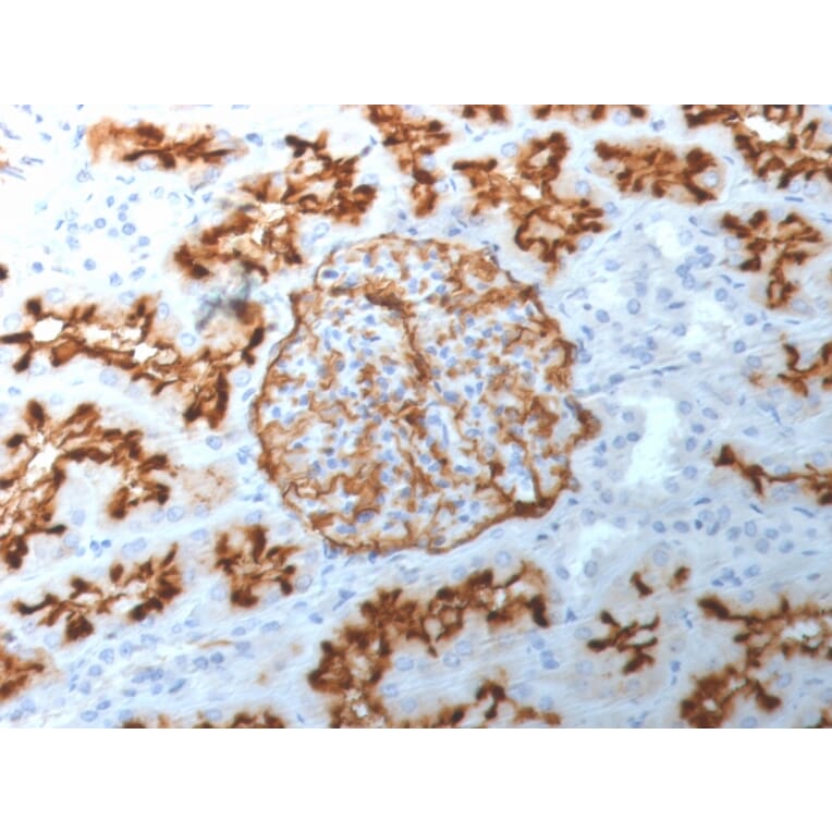 Immunohistochemistry - Anti-CD10 Antibody [MME/1892] (A249355) - Antibodies.com