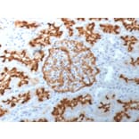 Immunohistochemistry - Anti-CD10 Antibody [MME/1892] (A249355) - Antibodies.com