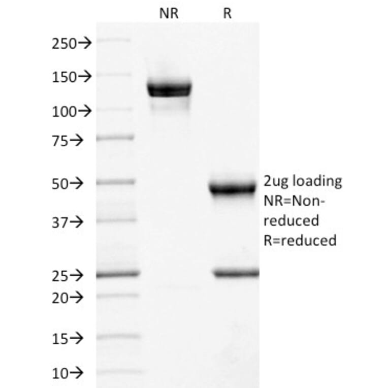 SDS-PAGE - Anti-CD10 Antibody [MME/1892] (A249355) - Antibodies.com