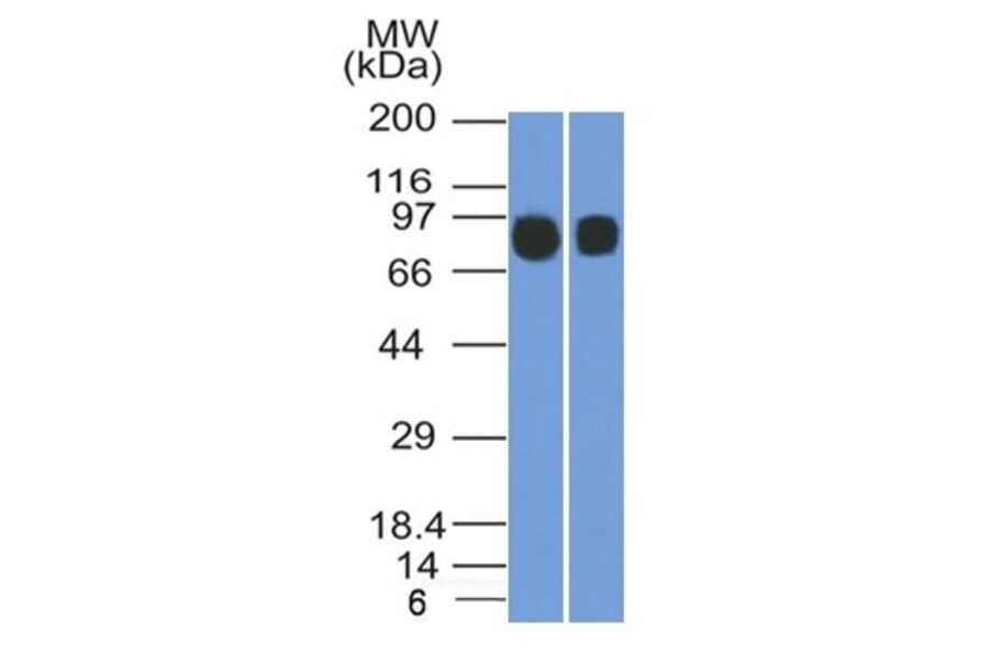 Western Blot - Anti-CD10 Antibody [MME/1892] (A249355) - Antibodies.com