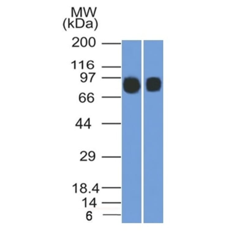 Western Blot - Anti-CD10 Antibody [MME/1892] (A249355) - Antibodies.com