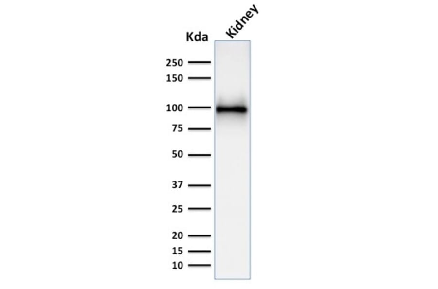 Western Blot - Anti-CD10 Antibody [MME/1892] (A249355) - Antibodies.com