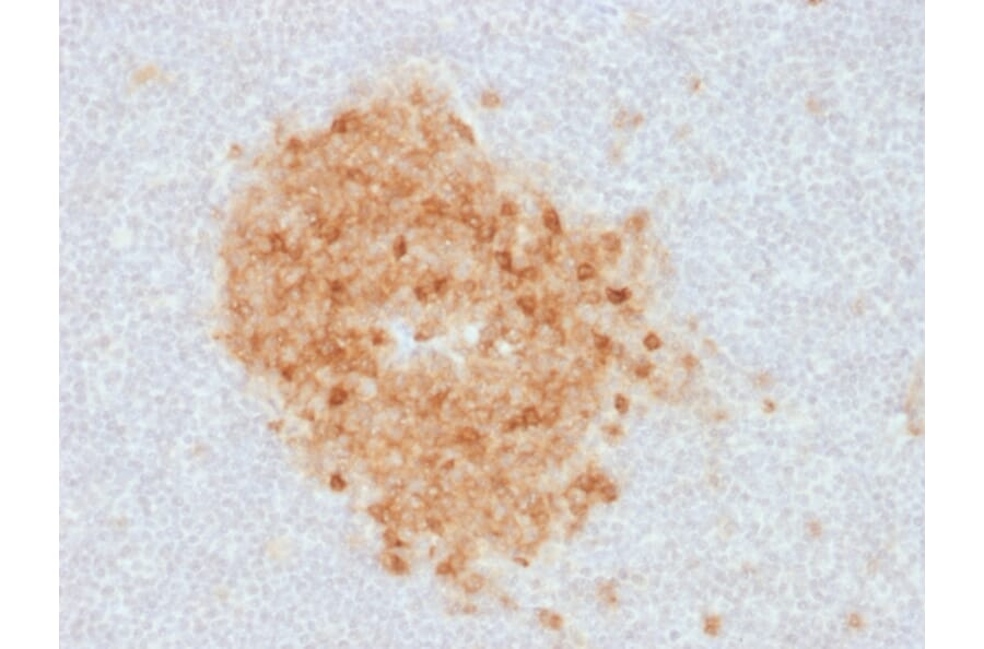 Immunohistochemistry - Anti-CD10 Antibody [MME/1893] (A249356) - Antibodies.com