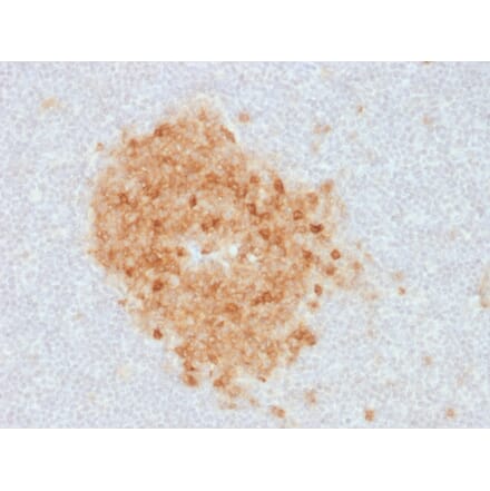 Immunohistochemistry - Anti-CD10 Antibody [MME/1893] (A249356) - Antibodies.com