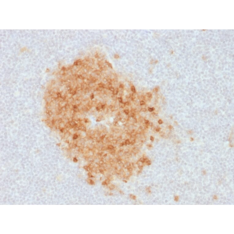 Immunohistochemistry - Anti-CD10 Antibody [MME/1893] (A249356) - Antibodies.com