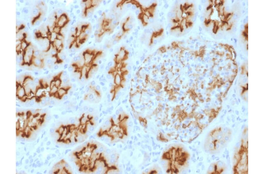 Immunohistochemistry - Anti-CD10 Antibody [MME/1893] (A249356) - Antibodies.com