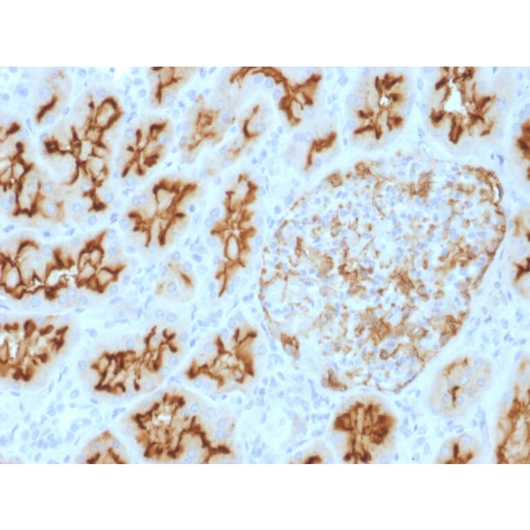 Immunohistochemistry - Anti-CD10 Antibody [MME/1893] (A249356) - Antibodies.com