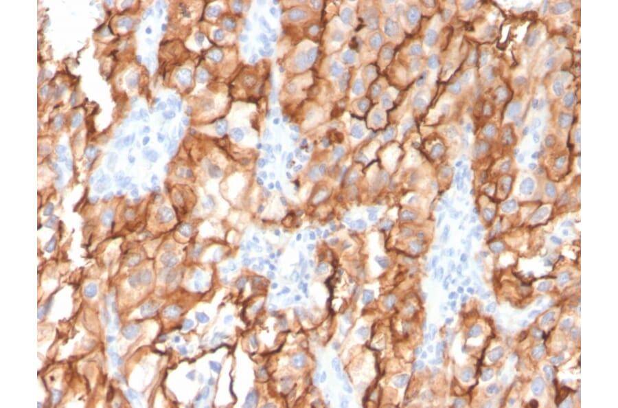 Immunohistochemistry - Anti-CD10 Antibody [MME/2579] (A249357) - Antibodies.com