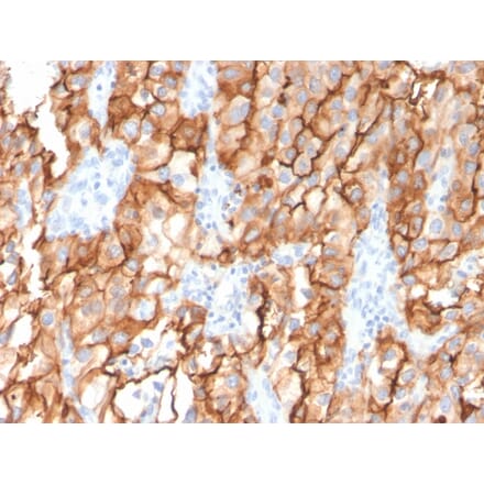 Immunohistochemistry - Anti-CD10 Antibody [MME/2579] (A249357) - Antibodies.com