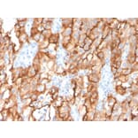Immunohistochemistry - Anti-CD10 Antibody [MME/2579] (A249357) - Antibodies.com