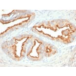 Immunohistochemistry - Anti-CD10 Antibody [MME/2579] (A249356) - Antibodies.com