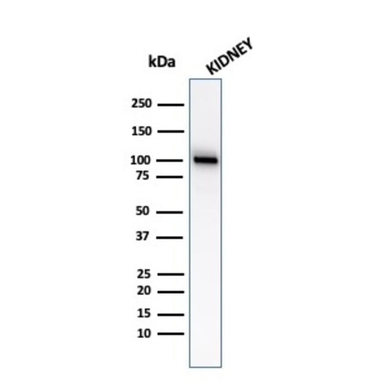 Western Blot - Anti-CD10 Antibody [MME/2579] (A249357) - Antibodies.com