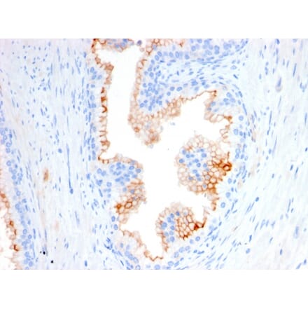 Immunohistochemistry - Anti-CD10 Antibody [MME/2580] (A249358) - Antibodies.com
