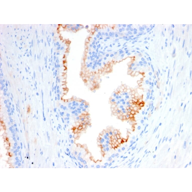 Immunohistochemistry - Anti-CD10 Antibody [MME/2580] (A249358) - Antibodies.com