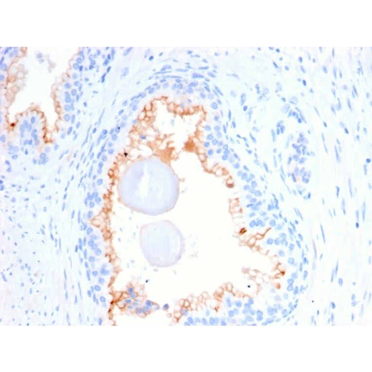 Immunohistochemistry - Anti-CD10 Antibody [MME/2580] (A249357) - Antibodies.com