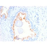 Immunohistochemistry - Anti-CD10 Antibody [MME/2580] (A249357) - Antibodies.com
