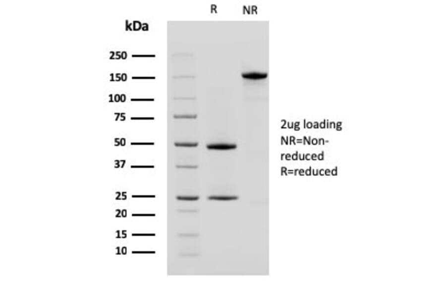 SDS-PAGE - Anti-CD10 Antibody [MME/2580] (A249358) - Antibodies.com