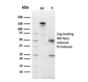 SDS-PAGE - Anti-CD10 Antibody [MME/2590] (A249359) - Antibodies.com