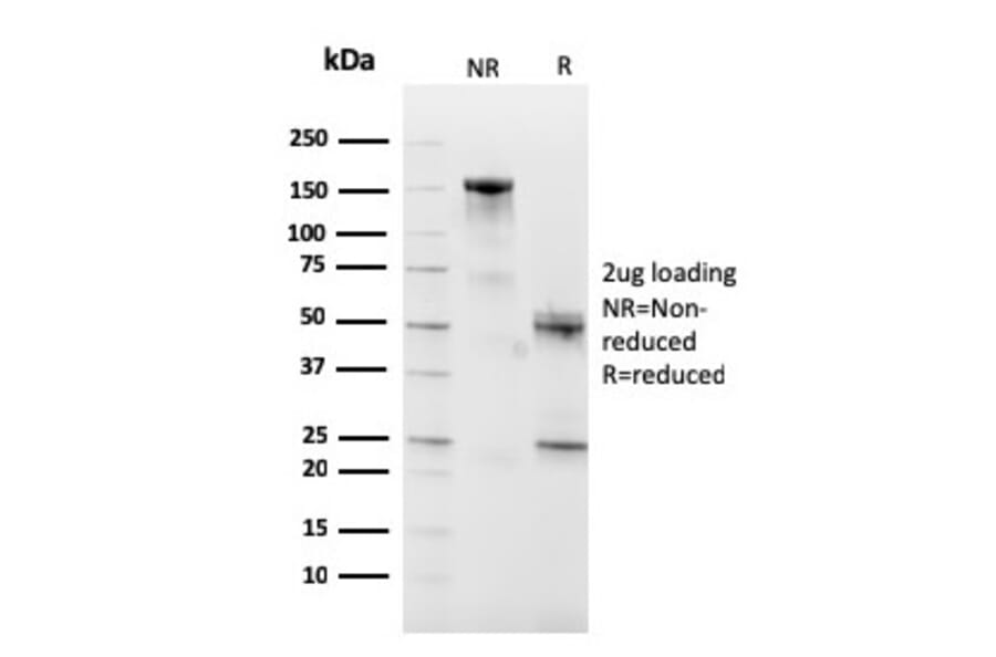 SDS-PAGE - Anti-CD10 Antibody [MME/2590] (A249359) - Antibodies.com